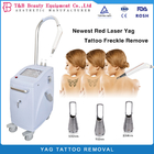 Nd Yag Q Switched Laser Device Tattoos Removal Machine