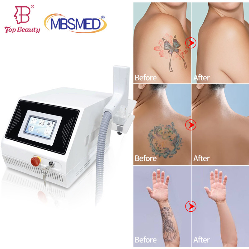 Portable 532nm 1320nm 1064nm Q Switched Nd Yag Laser Machine Tattoo Removal